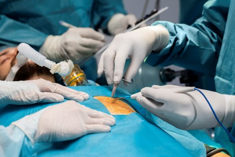 All About Laparoscopic Hernia Repair