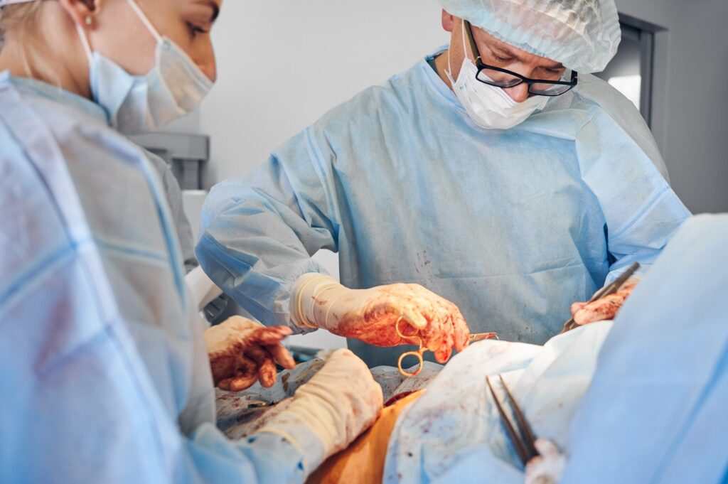 All About Laparoscopic Fundoplication